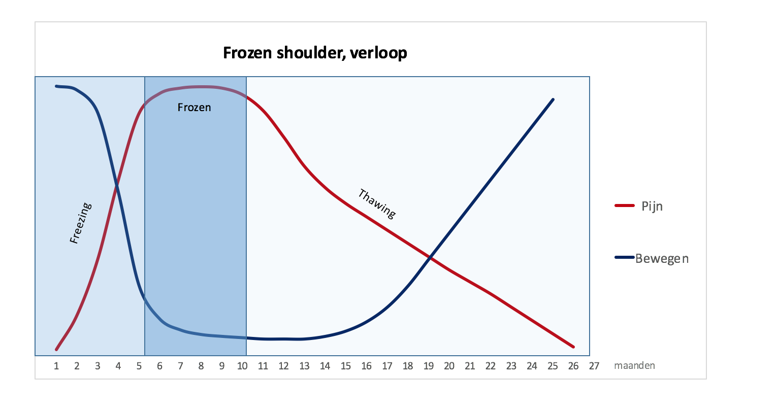 Frozen shoulder (de stijve schouder) Rijnland Orthopaedie